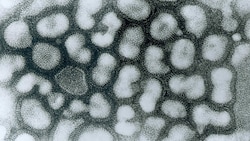 Elektronenmikroskopische Aufnahmen von Vogelgrippe-Viren (Bild: CDC/Erskine Palmer)