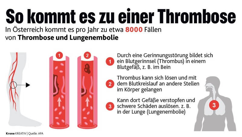 (Bild: Quelle: APA Grafik: Krone KREATIV)