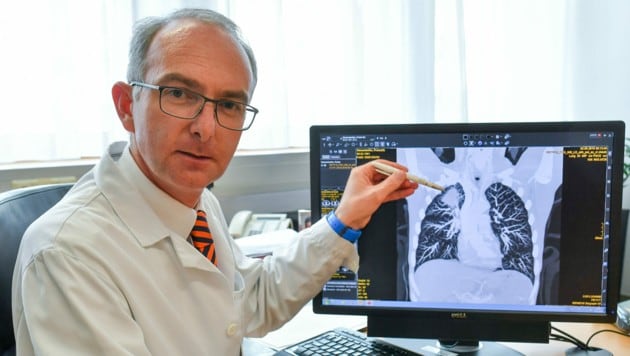 Der Linzer Lungen-Primar Bernd Lamprecht zeigt Veränderungen an einer Lunge durch Entzündung (Bild: © Harald Dostal / 2018)