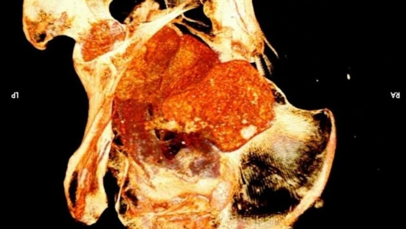 Die Röntgenaufnahme des Fötus im Bauch der ägyptischen Mumie (Bild: AFP/Warsaw Mummy Project/Aleksander Leydo)
