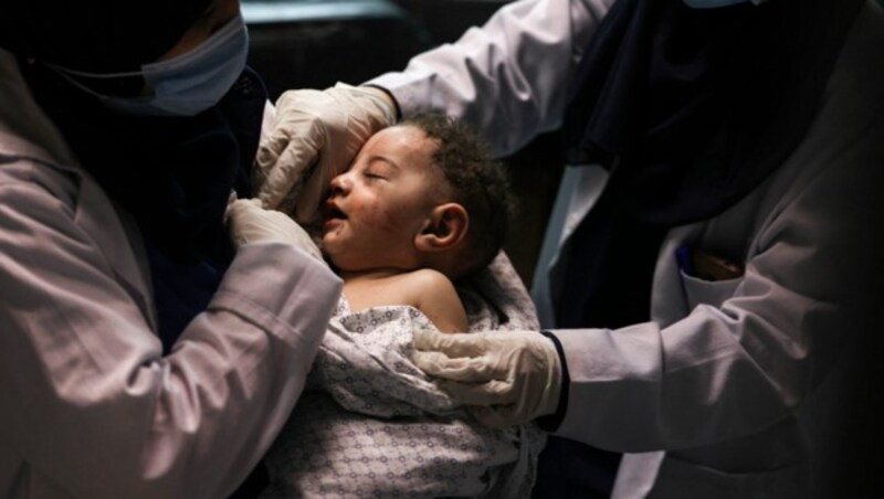 Dieses palästinensische Baby wurde aus dem Schutt gezogen und wird nun in einem Krankenhaus in Gaza Stadt behandelt. (Bild: AFP )