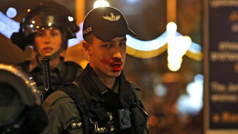 Dieser junge Beamte der israelischen Verteidigungskräfte wurde bei einer Auseinandersetzung mit palästinensischen Streitkräften verletzt. (Bild: AFP )