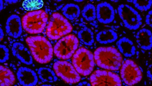 „Gute“ und „bösartige“ Zellen zeigen sich in unterschiedlichen Farben. (Bild: ©Yum/IMBA)