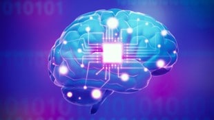 Was geschieht, wenn Neuroimplantate keine Updates mehr erhalten? (Bild: stock.adobe.com)