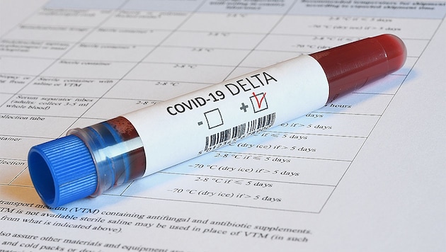 Die Delta-Variante des Coronavirus verbreitet sich so leicht wie die sehr ansteckenden Windpocken. (Bild: © Dan74 - stock.adobe.com)