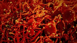 Abbildung von Zellen (rot), die mit dem Coronavirus SARS-CoV-2 (gelb) infiziert sind. (Bild: NIAID)
