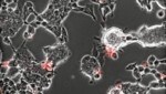 Das Coronavirus (rote Flecken) attackiert (Bild: Institut Pasteur, Department of Virology/Sophie-Marie Aicher, Dr. Delphine Planas)