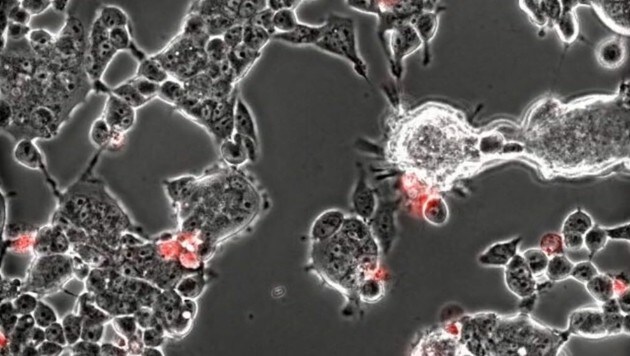 Das Coronavirus (rote Flecken) attackiert (Bild: Institut Pasteur, Department of Virology/Sophie-Marie Aicher, Dr. Delphine Planas)