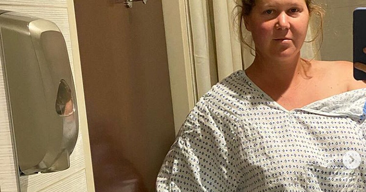 “So, so much blood” – Amy Schumer had to have her uterus removed