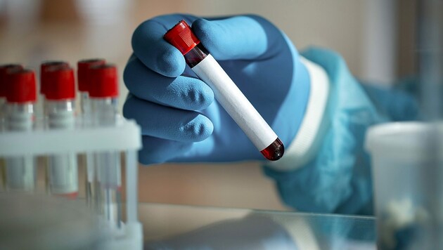 Part of the check-up is the blood test (symbolic image). (Bild: stock.adobe.com)