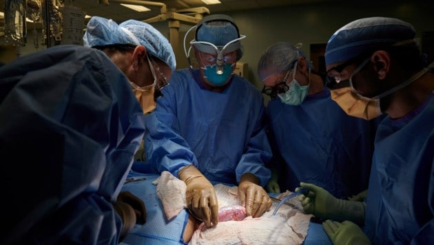 Hier verbindet das Chirurgenteam im New Yorker Spital die Schweineniere an einen hirntoten Menschen, der durch künstliche Beatmung am Leben erhalten wurde. (Bild: NYU Langone Health)