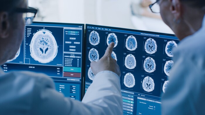 MRT-Untersuchungen können bei Alzheimer wichtig sein.
