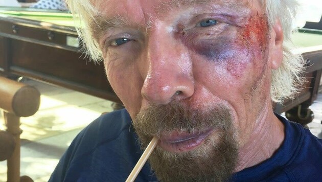 Der Milliardär Sir Richard Branson ist nach seinem Fahrradunfall schwer angeschlagen. (Bild: Branson Family)