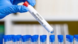 Ungeimpfte Omikron-Genesene haben kaum Antikörper, wie eine Innsbrucker Studie zeigt. (Bild: © Daniel Ernst - stock.adobe.com)