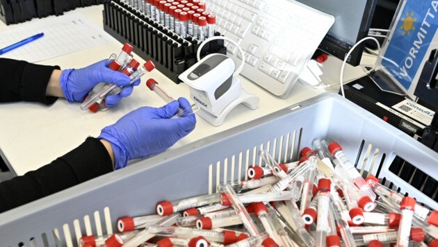 Auswertung von PCR-Tests: Ganz wird das Coronavirus wohl nie verschwinden. (Bild: APA/HANS PUNZ)