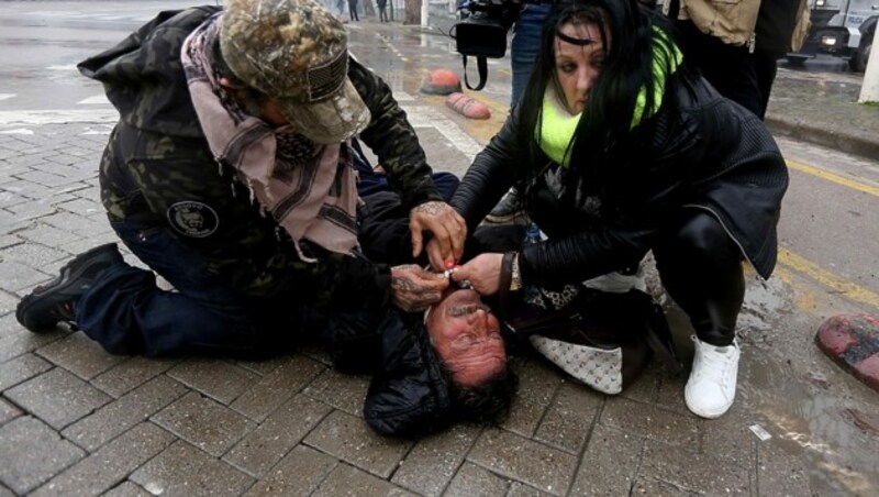 Ein verletzter Demonstrant in Tirana (Bild: APA/AFP/Gent SHKULLAKU)