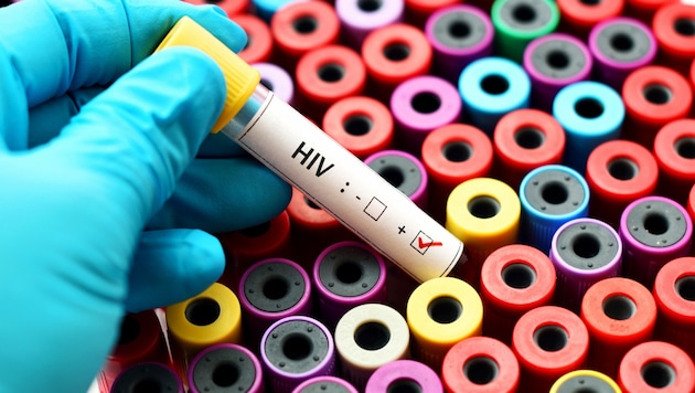 HIV-Test (Symbolbild) (Bild: jarun011 - stock.adobe.com)