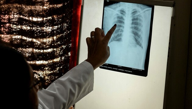 Röntgenaufnahme eines Patienten in Indien (Bild: APA/AFP/NOAH SEELAM)