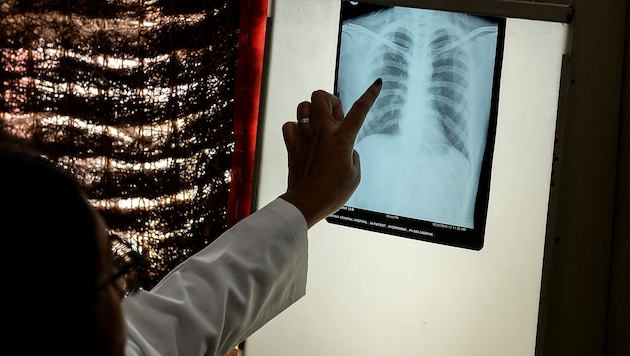 Röntgenaufnahme eines Patienten in Indien