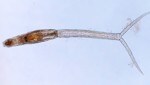 Una cercaria (larva) de la especie de caracol Trichobilharzia physellae, que ahora se ha detectado por primera vez en Europa y también en Austria (Imagen: NHM Viena/N. Helmer)