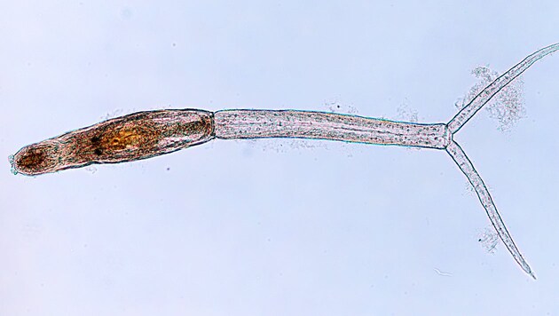 Eine Zerkarie (Larve) der Saugschnecken-Art Trichobilharzia physellae, die jetzt erstmals in Europa und auch in Österreich nachgewiesen wurde
 
 (Bild: NHM Wien/N. Helmer)