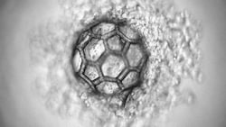 Mikroskopaufnahme eines Mikro-Scaffolds (Bild: TU Wien)