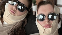 Ireland Baldwin ließ sich gemeinsam mit ihrer Cousine Alaia ein Facelifiting machen. (Bild: instagram.com/irelandbasingerbaldwin)