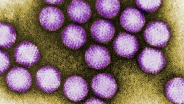 Kolorierte elektronenmikroskopische Aufnahme einer Ansammlung von Adenoviren (Bild: CDC/ Dr. G. William Gary, Jr. (Public domain))