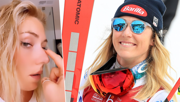 „Nase Fällt Herunter“ - Shiffrin Warnt Ihre Fans Vor Den Sozialen ...