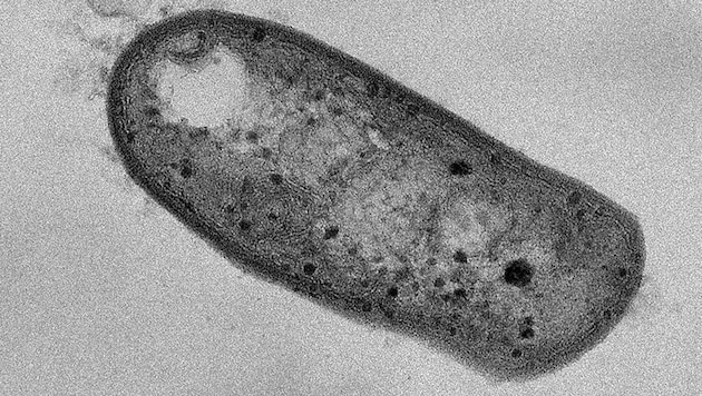 Elektronenmikroskopische Aufnahme des Bakteriums Methylovirgula thiovorans (Bild: © Sung-Keun Rhee)