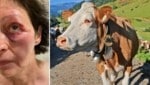 Petra M. sufrió el ataque de la vaca en junio en el Stubaital, entre otras cosas, contusiones e hinchazón en la cara.  (Imagen: zVg, Christof Birbaumer (imagen del símbolo))