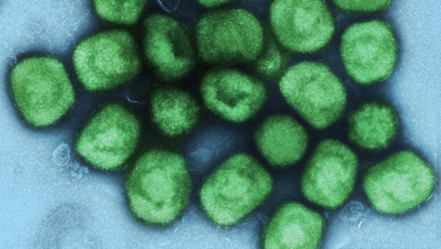 Electron microscopic and stained image of the pathogen (Bild: NIAID)