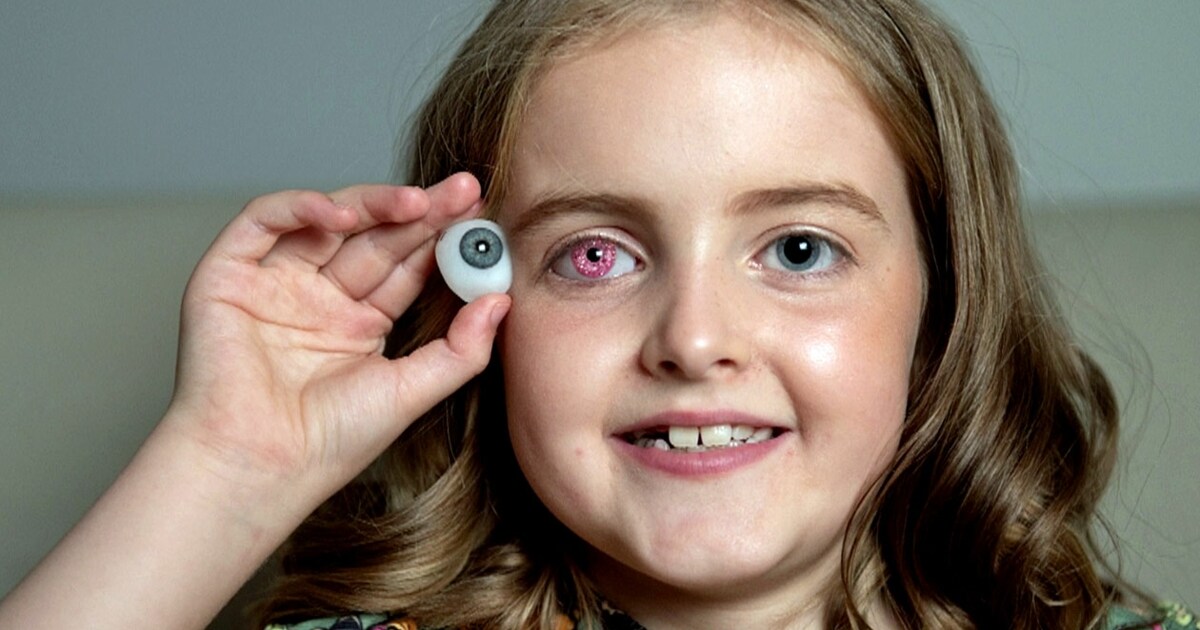 Brit (8) Surprises With Pink “superhero Eye” 