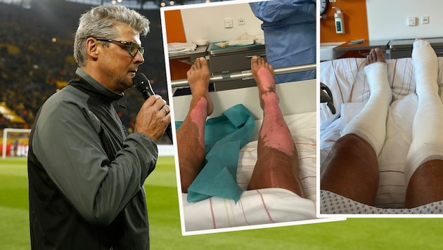Norberg Dickel links im Jahr 2017 in seinem Element im Dortmunder Stadion. Die Bilder rechts zeigen seine Beine im Spital (Bild: AFP, Instagram.com/bvbnobby)