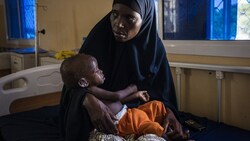 Eine Mutter hält ihr unterernährtes Baby in einem Spital in Somalia (Bild: AFP)