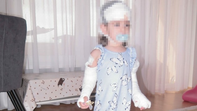 Die zweijährige Zara erlitt bei ihrem 13-Meter-Sturz mehrere Brüche (Bild: Markus Schütz)