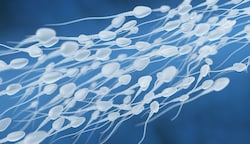 WLAN wirkt sich negativ auf Spermien-Proben aus. (Bild: stock.adobe.com)