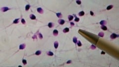 Die Spermienzahl bei Männern nimmt laut einer neuen Studie weltweit immer rascher ab. (Bild: APA/dpa-Zentralbild/Jan Woitas)