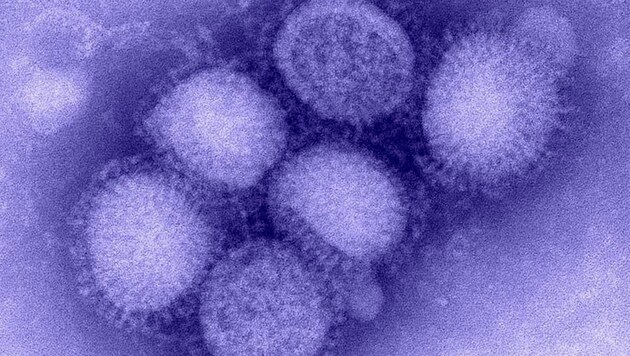 Elektronenmikroskopische und eingefärbte Aufnahme von Grippeviren. (Bild: CDC)