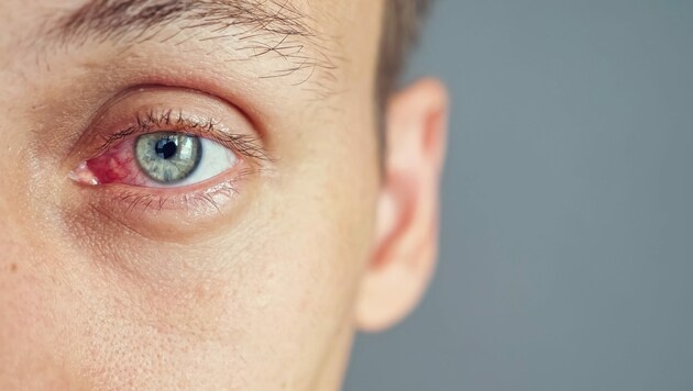 Vor allem Träger von Kontaktlinsen leiden in der kalten Jahreszeit an gereizten Augen. (Bild: lenblr/stock.adobe.com)