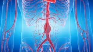 Los agrandamientos patológicos de la aorta abdominal son un peligro subestimado.  (Imagen: stock.adobe.com)
