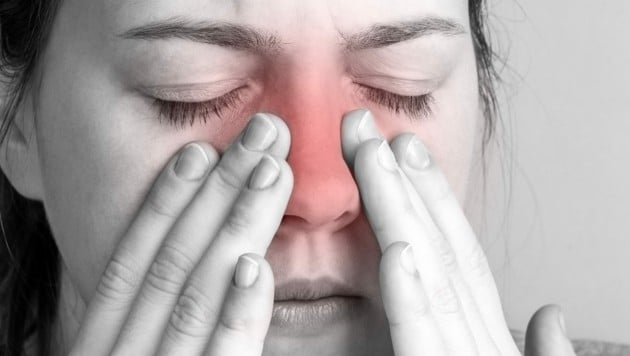 Eine rinnende oder verstopfte Nase in Kombination mit eingeschränktem Geruchssinn und Druckgefühl im Gesicht können Anzeichen für Sinusitis sein. (Bild: Natallia/stock.adobe.com)