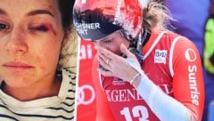 Nach wie vor leidet Corinne Suter unter den Folgen des heftigen Abflugs. (Bild: GEPA, instagram.com/corinnesuter_official)