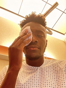 Tammy Abraham verletzte sich am Auge und könnte gegen den FC Salzburg ausfallen. (Bild: Instagram/Tammy Abraham)