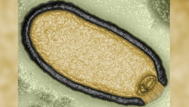 Eine digitale Darstellung des als „Zombievirus“ bezeichneten Pithovirus sibericum. Es ist rund 30.000 Jahre alt - und wieder infektiös. (Bild: Jean-Michel Claverie/Aix-Marseille Université)