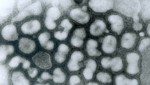 Elektronenmikroskopische Aufnahme eines H5N1-Virus (Bild: CDC/Dr. Erskine Palmer (gemeinfrei))