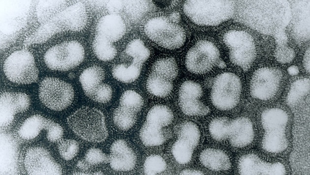 Elektronmikroszkópos felvétel a H5N1 vírusról (Bild: CDC/Dr. Erskine Palmer (gemeinfrei))
