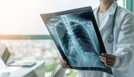 Schon 1901 erhielt Wilhelm Conrad Röntgen für seine Arbeit den ersten Nobelpreis für Physik.