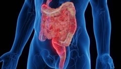 Die Entzündungen bei Morbus Crohn können nicht nur den Darm, sondern den gesamten Verdauungstrakt betreffen.  (Bild: stock.adobe.com, Krone KREATIV)