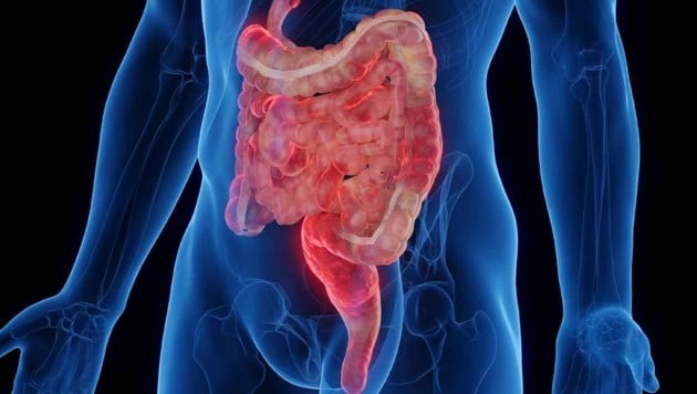 Die Entzündungen bei Morbus Crohn können nicht nur den Darm, sondern den gesamten Verdauungstrakt betreffen.  (Bild: stock.adobe.com, Krone KREATIV)